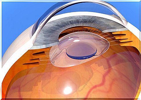 Intraocular lens